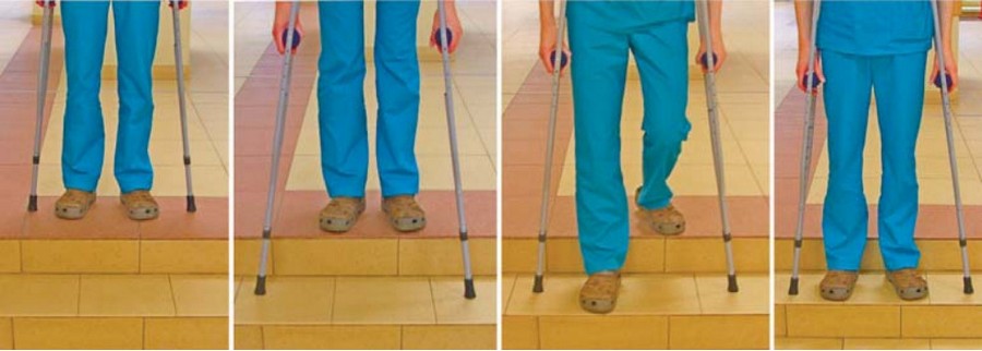 Какие костыли после операции. Костыли при переломах. Ходьба на костылях эндопротезирования коленного сустава. Костыли при переломе ноги. Ходьба на костылях после операции тазобедренного сустава.